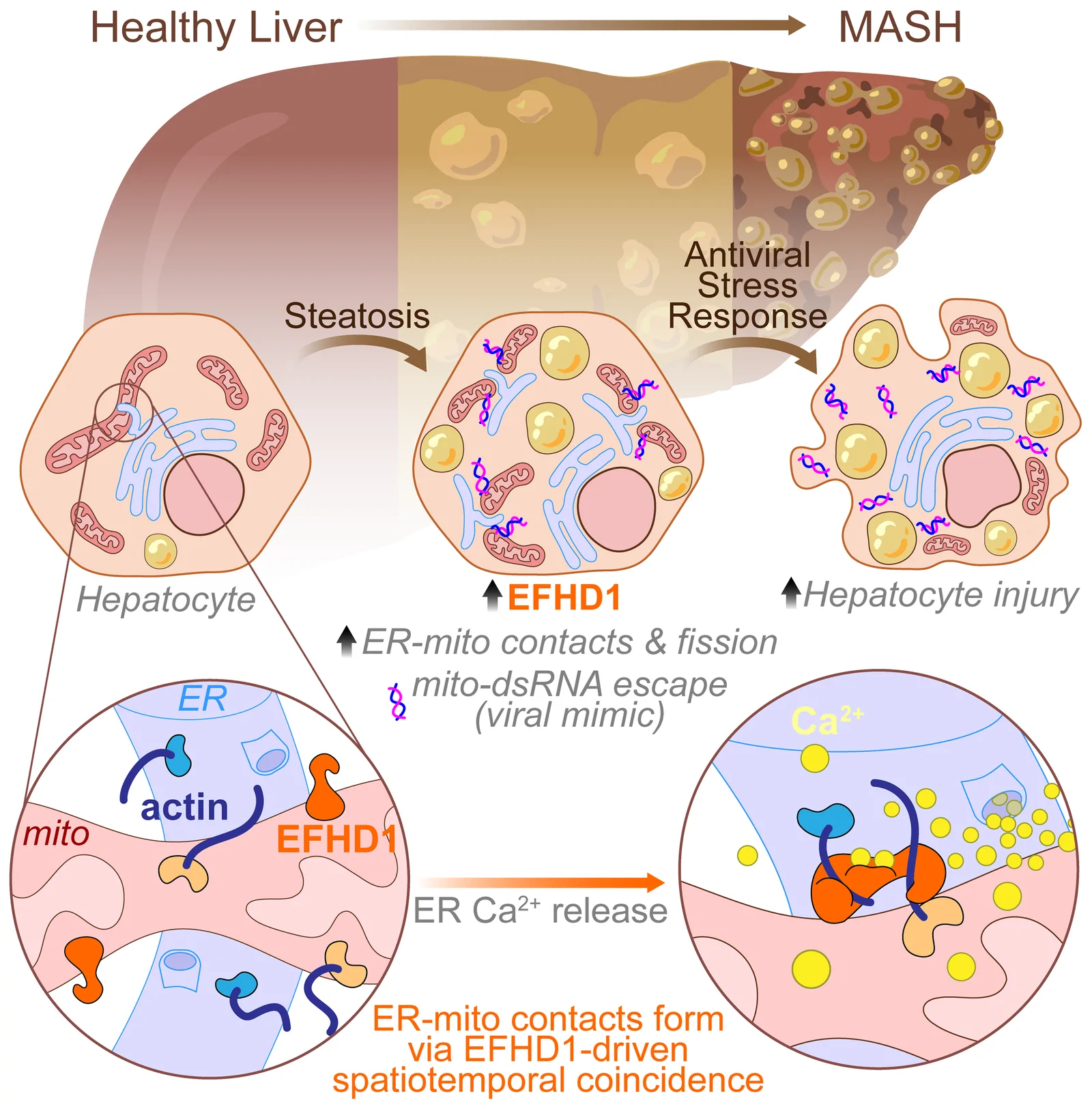 Illustration: as a healthy liver progresses to metabolic liver disease (MASH), EFHD1 rises in hepatocytes, ER-mitochondria contacts and mitochondrial fission increase, and mitochondrial double-stranded RNA escapes. Insets show EFHD1 bundling actin across an ER-mitochondria contact when the ER releases calcium.